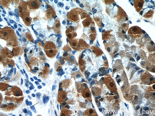 [66869-1-IG-20UL] Annexin A10 Monoclonal antibody