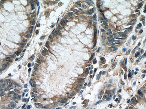 [66876-1-IG-20UL] STIL Monoclonal antibody