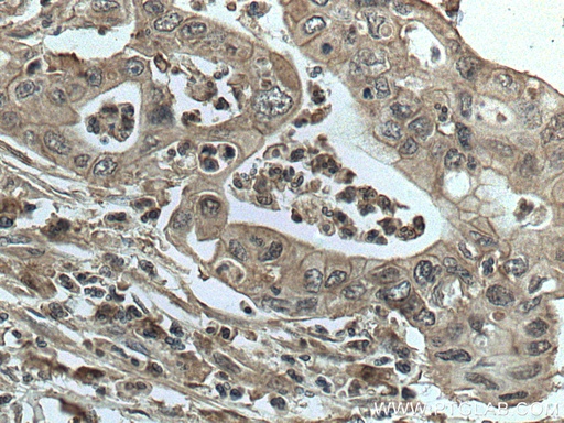 [66880-1-IG-150UL] GRB2 Monoclonal antibody