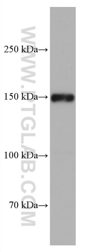 [66890-1-IG-20UL] Jagged1 Monoclonal antibody