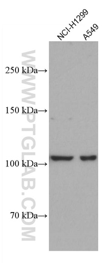 [66894-1-IG-20UL] DLC1 Monoclonal antibody