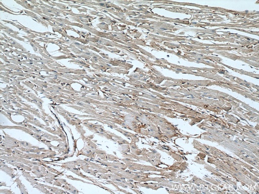 [66895-1-IG-150UL] Alpha Actinin Monoclonal antibody