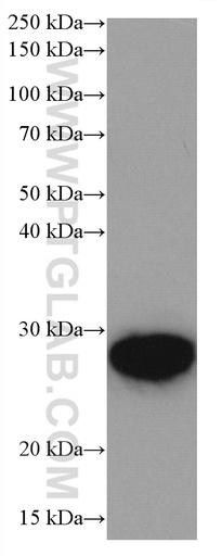 [66897-1-IG-150UL] UBE2S Monoclonal antibody