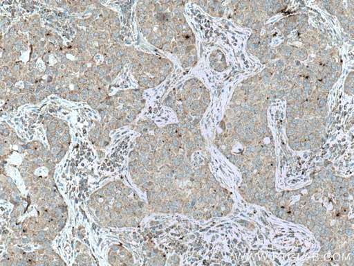 [66898-1-IG-20UL] UPF1 Monoclonal antibody