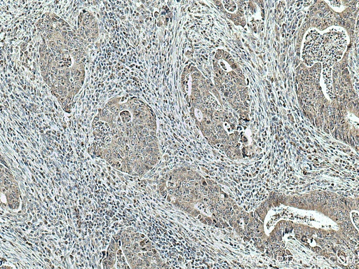 [66899-1-IG-150UL] SPTLC1 Monoclonal antibody