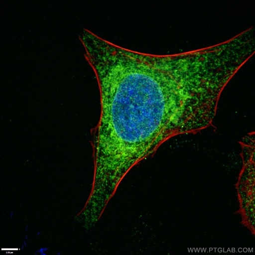 [66903-1-IG-20UL] Calnexin Monoclonal antibody