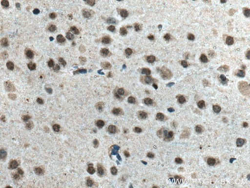 [66904-1-IG-150UL] Glucocorticoid receptor Monoclonal antibody