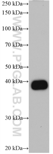 [66909-1-IG-20UL] CA6 Monoclonal antibody