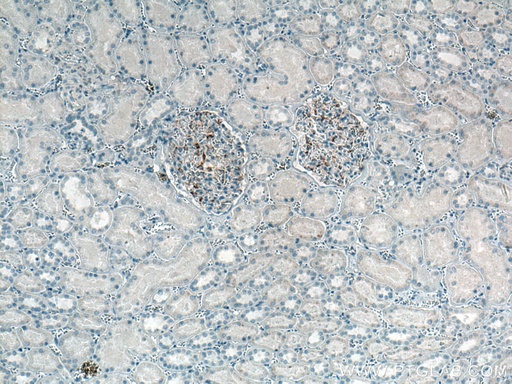 [66910-1-IG-20UL] INF2 Monoclonal antibody