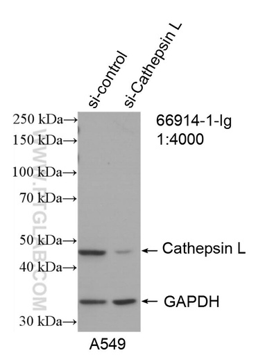 [66914-1-IG-20UL] Cathepsin L Monoclonal antibody