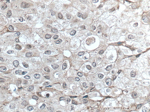 [66916-1-IG-20UL] TFG Monoclonal antibody