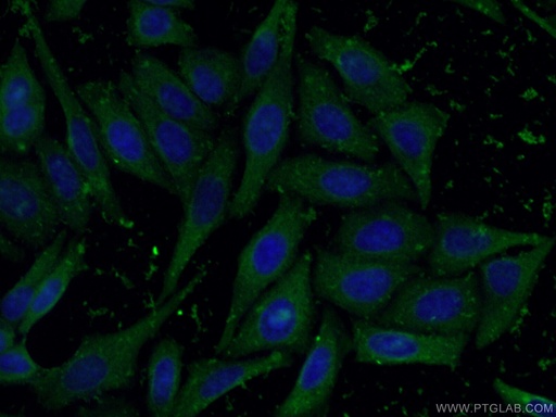 [66917-1-IG-20UL] NFATC2 Monoclonal antibody