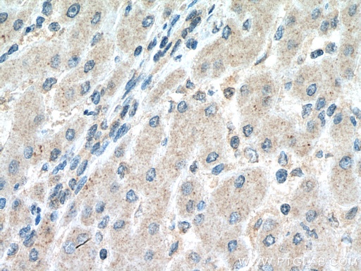 [66920-1-IG-20UL] NFKB2 Monoclonal antibody