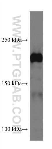 [66922-2-IG-20UL] Integrin Beta 4 Monoclonal antibody