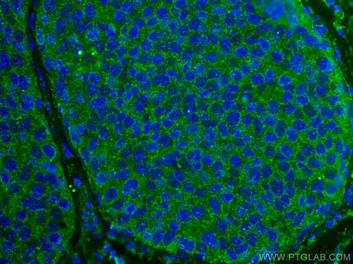 [66923-1-IG-20UL] ROR1 Monoclonal antibody