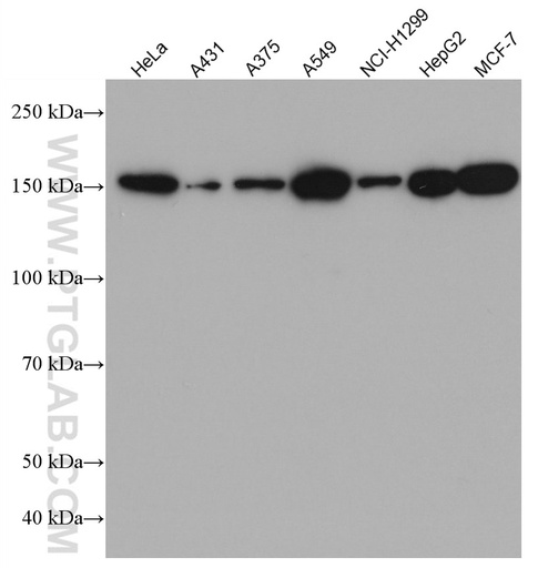 [66928-1-IG-20UL] CFTR Monoclonal antibody