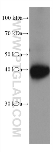[66931-1-IG-20UL] Kir4.1 Monoclonal antibody