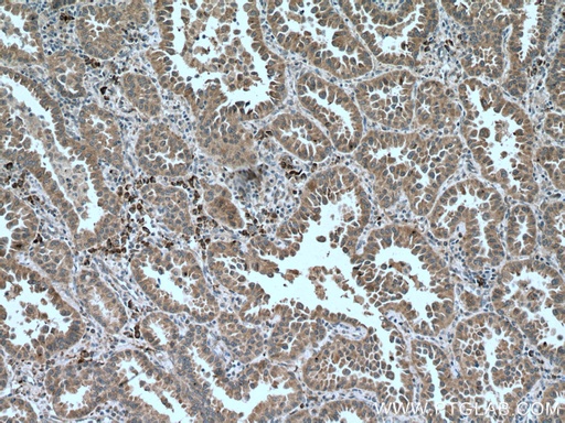 [66934-1-IG-20UL] PHEX Monoclonal antibody
