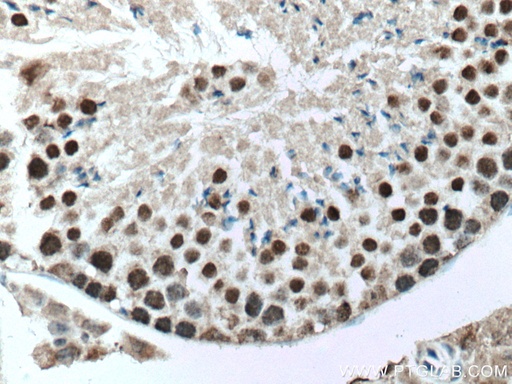 [66937-1-IG-20UL] UBR5 Monoclonal antibody