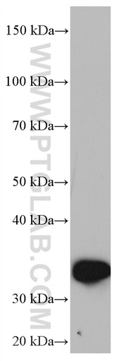 [66938-1-IG-20UL] ZFP36 Monoclonal antibody