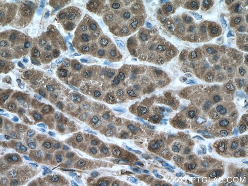 [66939-1-IG-20UL] ADH1B Monoclonal antibody