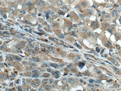 [66943-1-IG-150UL] GIMAP5 Monoclonal antibody