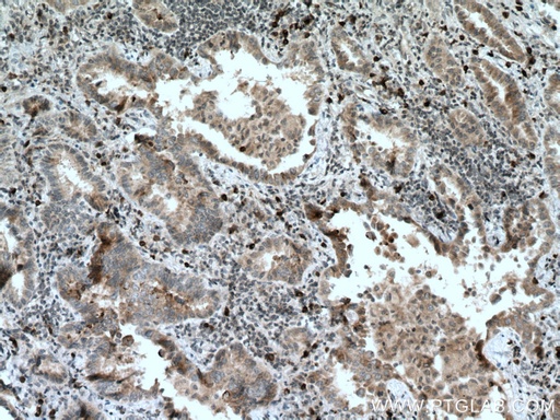 [66944-1-IG-150UL] RAB27B Monoclonal antibody