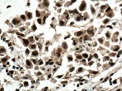 [66950-1-IG-20UL] CDK4 Monoclonal antibody