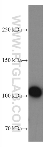 [66952-1-IG-20UL] Integrin Beta 3 Monoclonal antibody