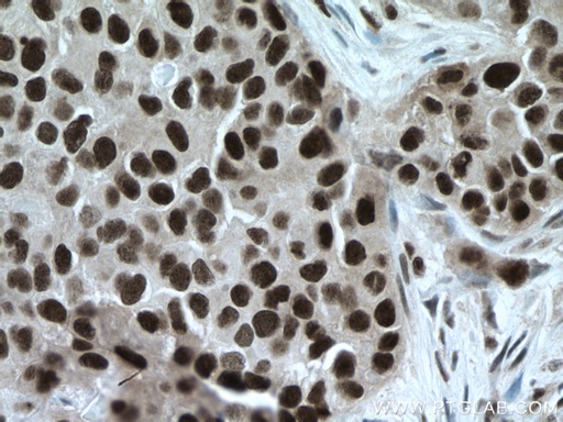 [66955-1-IG-150UL] TBL1X Monoclonal antibody