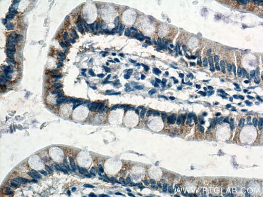 [66956-1-IG-150UL] NOTUM Monoclonal antibody