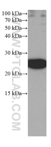 [66959-1-IG-20UL] RRAS Monoclonal antibody