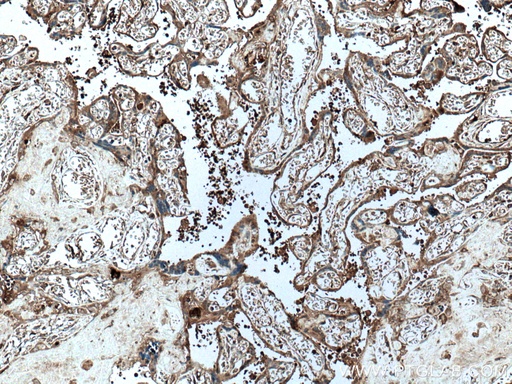 [66962-1-IG-20UL] PAPPA Monoclonal antibody