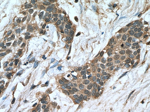 [66963-1-IG-20UL] NFATC1 Monoclonal antibody
