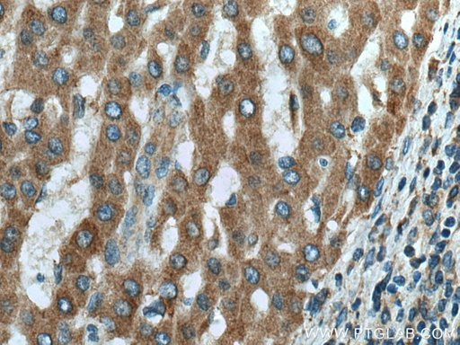 [66969-1-IG-150UL] DOCK2 Monoclonal antibody