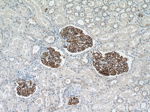 [66970-1-IG-150UL] Nephrin Monoclonal antibody