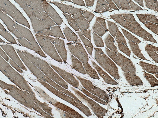 [66974-1-IG-20UL] HK2 Monoclonal antibody