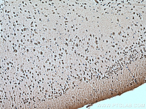 [66976-1-IG-20UL] FOX2/RBM9 Monoclonal antibody