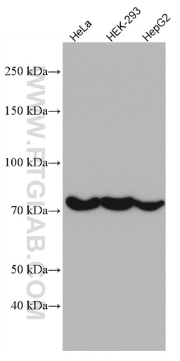 [66977-1-IG-150UL] CAPN2 Monoclonal antibody