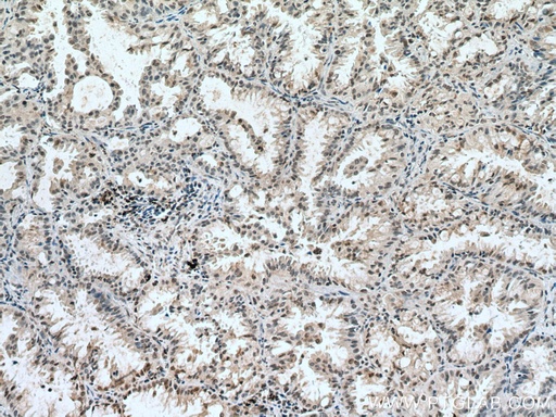 [66978-1-IG-150UL] CUL1 Monoclonal antibody