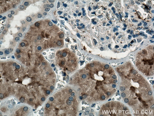 [66979-1-IG-20UL] FTCD Monoclonal antibody