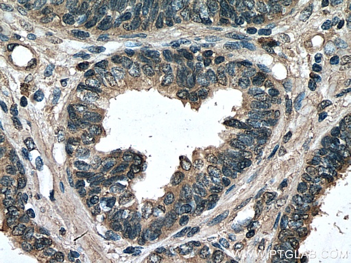 [66981-1-IG-150UL] PREB Monoclonal antibody