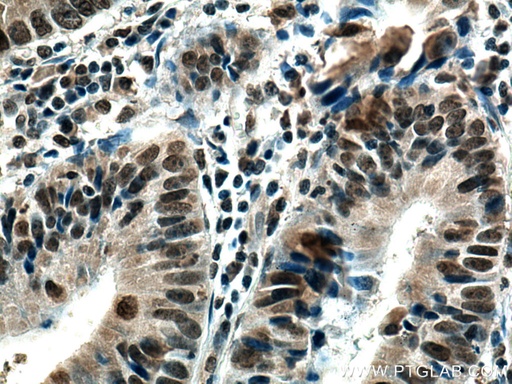 [66987-1-IG-20UL] SMC1A Monoclonal antibody