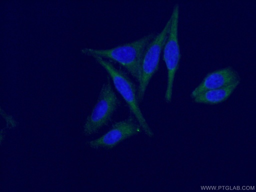 [66988-1-IG-20UL] LHPP Monoclonal antibody