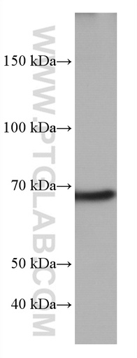 [66990-1-IG-150UL] TP73 Monoclonal antibody