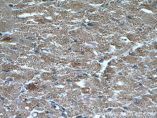 [66993-1-IG-150UL] UBAP1 Monoclonal antibody