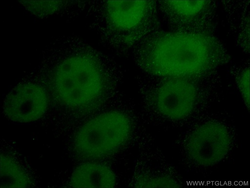 [66995-1-IG-20UL] CTBP1 Monoclonal antibody