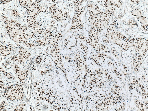 [67001-1-IG-20UL] NUP50 Monoclonal antibody