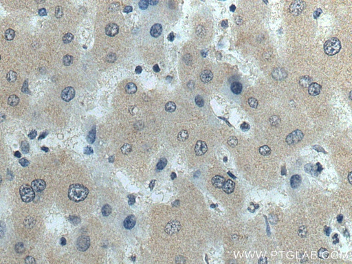[67002-1-IG-150UL] fetuin-B Monoclonal antibody