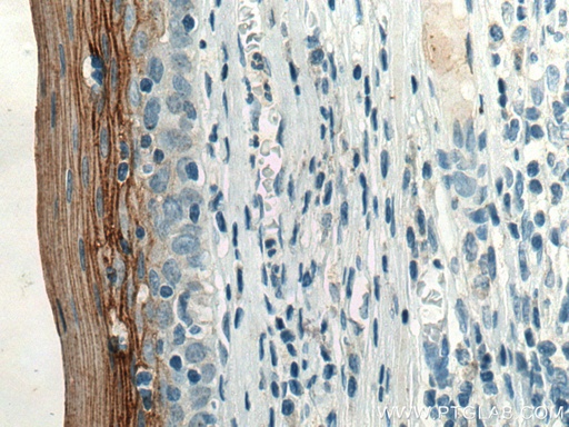 [67004-1-IG-150UL] TGM1 Monoclonal antibody